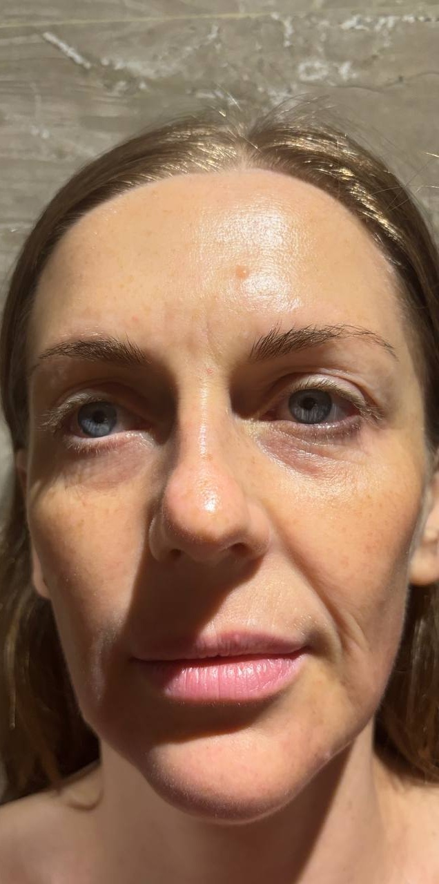 Client 3 after