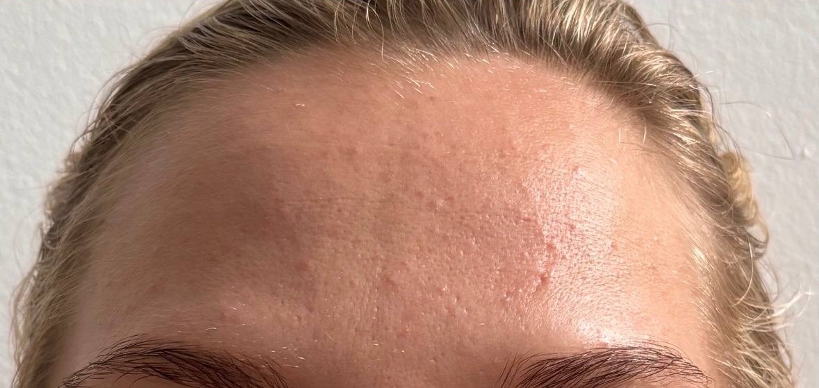 Client 6 after